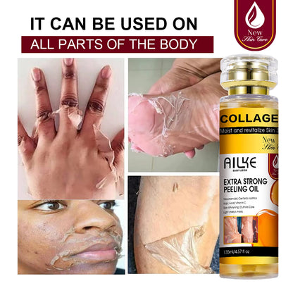 AILKE Collagen Extra Strong Peeling Oil, Whitening Skin, Exfoliating Solution for Face, Body, Hand, Feet, for All Skin Types